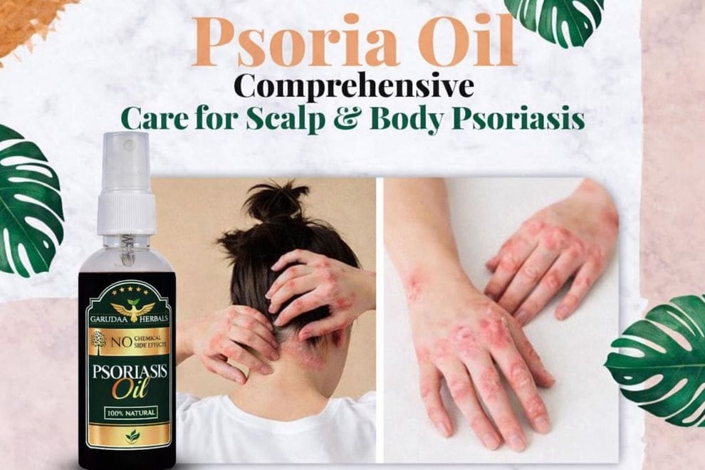 Garuda Herbal Psoriasis Oil