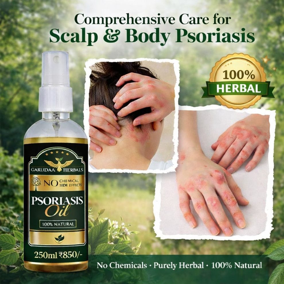 Garuda Herbal Psoriasis Oil